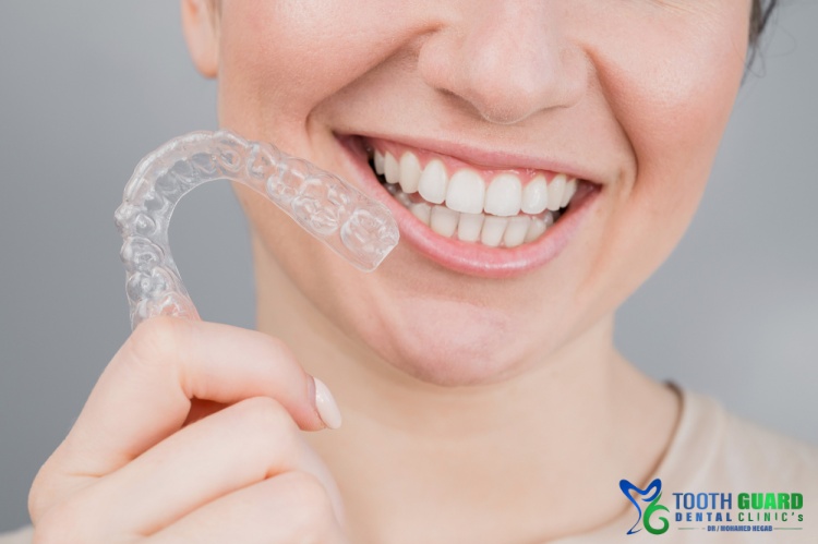 سعر تقويم الاسنان الشفاف فى مصر